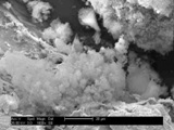 aluminum hydroxide